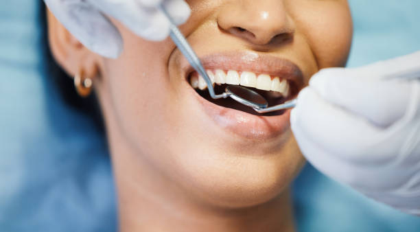 Best Emergency Dentist for Lost Fillings or Crowns in Bridge City, TX