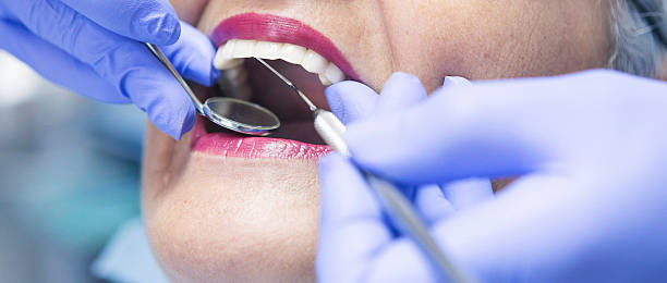 Best Mobile Emergency Dentist in Bridge City, TX