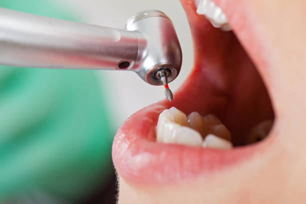 Best Pediatric Emergency Dentist in Bridge City, TX